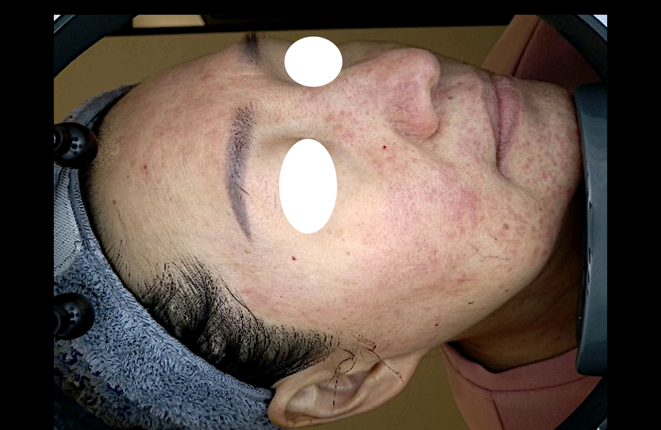 Patient photo 1
