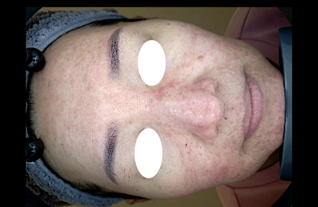 Patient photo 2