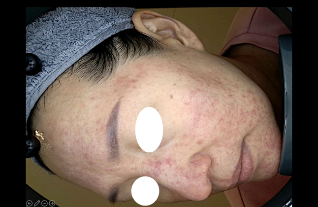 Patient photo 3